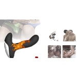 Stimolatore prostatico riscaldato