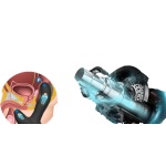 Stimolatore prostatico riscaldato