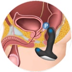 Stimolatore prostatico riscaldato